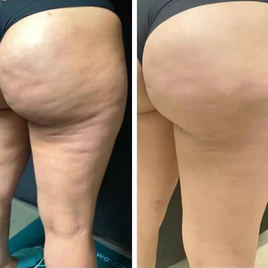 Feature product image