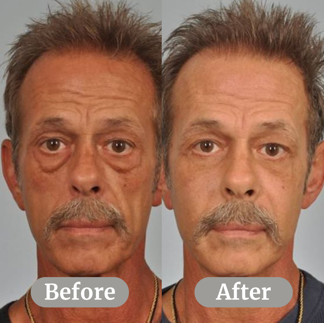 Depuffing Serum