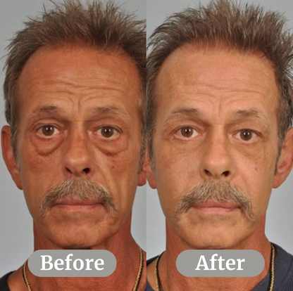 Depuffing Serum
